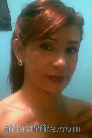 153461 - Grace Age: 50 - Colombia